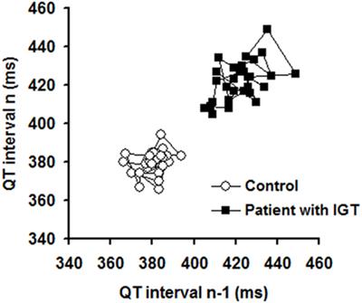 Increased Short-Term Beat-to-Beat QT Interval Variability in Patients with Impaired Glucose Tolerance